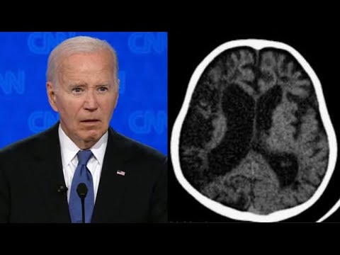 Postmortem Analysis: The Worst Debate in Human History
