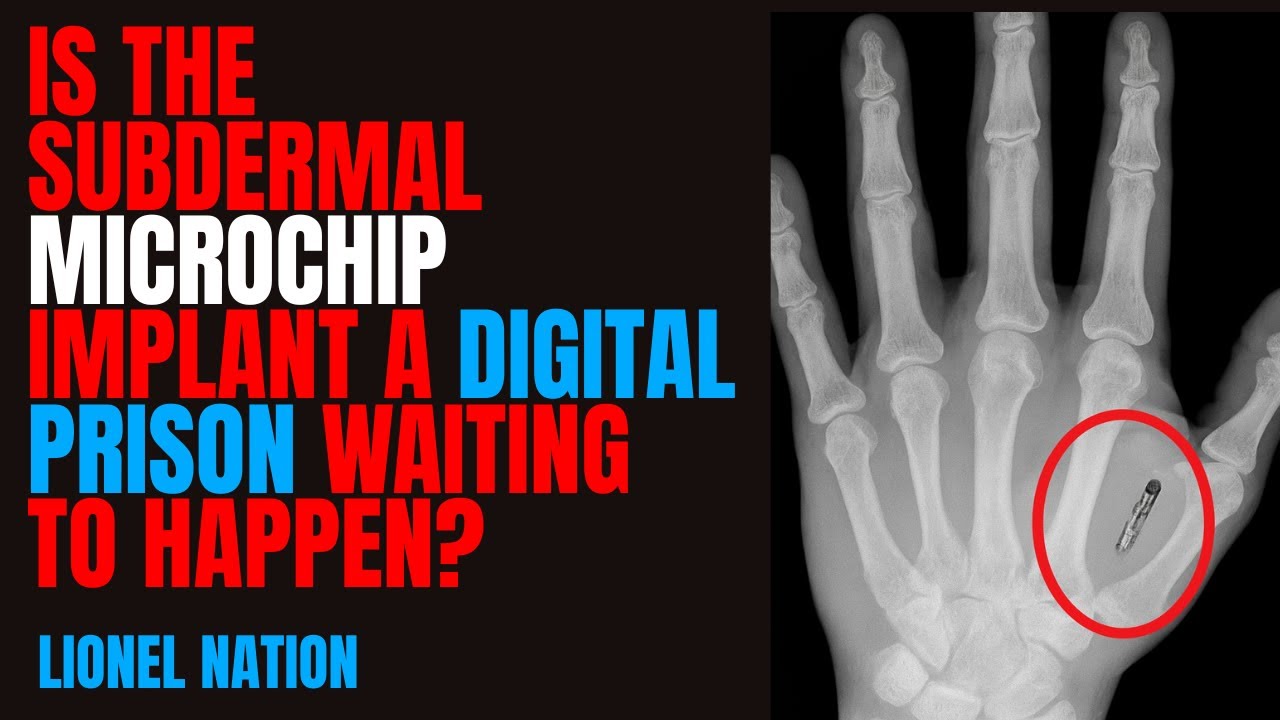 Is the Subdermal MICROCHIP Implant a Digital Prison Waiting to Happen?